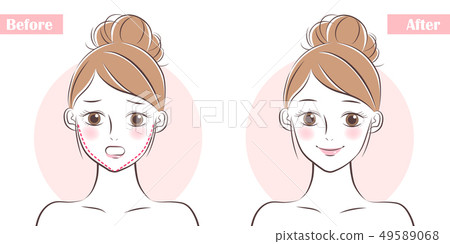 face about plastic surgery 49589068