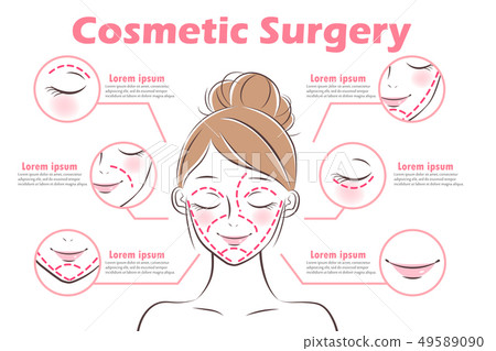 the girl with cosmetic surgery 49589090