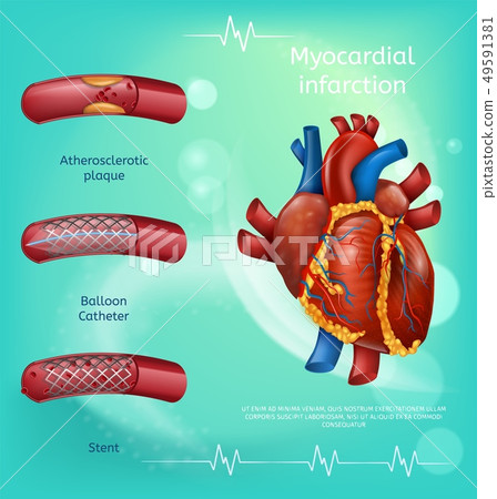 Banner Image Realistic Blood Vessels Human Heart Banner Image Realistic Blood Vessels Human Heart 49591381