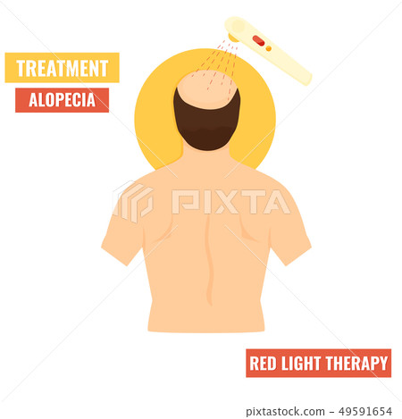 Hair growth stimulation. Red light therapy 49591654