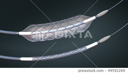 Stent and catheter,implant into blood vesssel 49592269