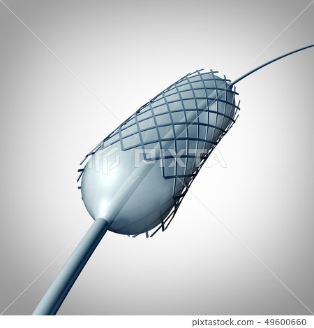 Catheter Stent Implantation 49600660