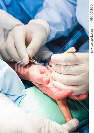 Surgeon suturing the hand of a patient Surgeon suturing the hand of a patient 49605390