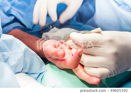 Surgeon suturing the hand of a patient 49605392