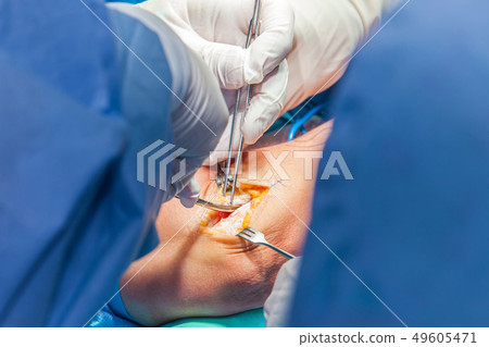 Orthopedic surgeons performing arm surgery Orthopedic surgeons performing arm surgery 49605471