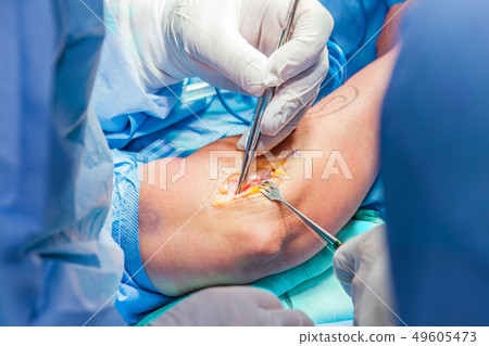 Orthopedic surgeons performing arm surgery 49605473