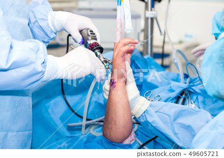 Orthopedic surgeons performing a wrist arthroscopy 49605721