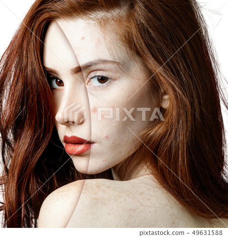 Young woman before and after skin treatment and makeup. 49631588