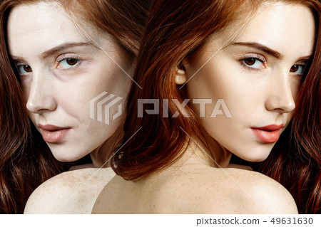 Young woman before and after rejuvenation. 49631630