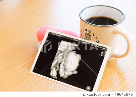 Echo photo and coffee 49641679