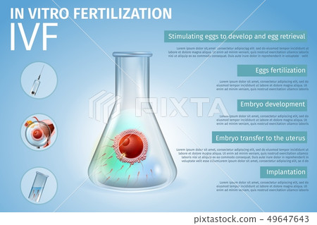 In Vitro Fertilization Stages Process Composition. 49647643