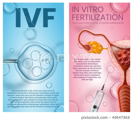Eggs Fertilised in Lab and Implanted Into Uterus 49647868
