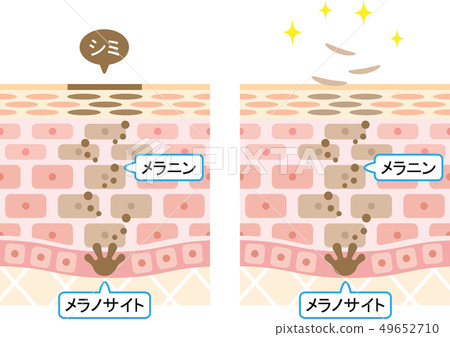 周轉皮膚剖面圖 49652710