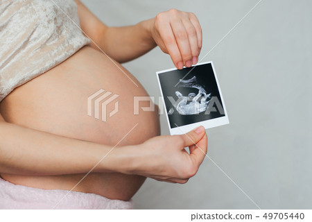 photo of a pregnant ultrasound in the hands of a pregnant girl photo of a pregnant ultrasound in the hands of a pregnant girl 49705440