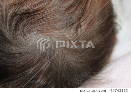 頭髮螺紋 頭髮螺紋 49743185