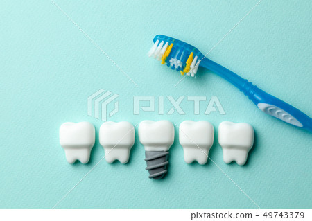 Healthy white teeth and implants on green mint background with toothbrush 49743379