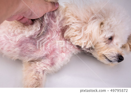 Body with red irritated skin due to 49795872