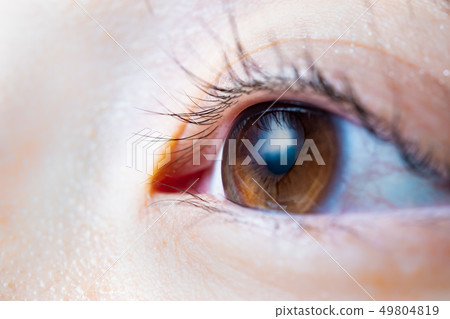 Human eye 49804819