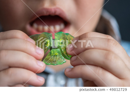 the boy inserts an orthodontic plate into his the boy inserts an orthodontic plate into his 49812729