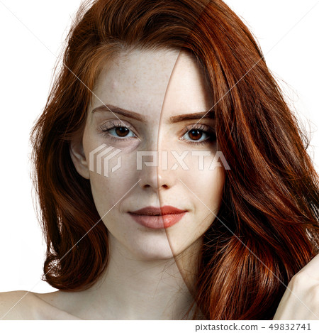 Young woman before and after rejuvenation. 49832741