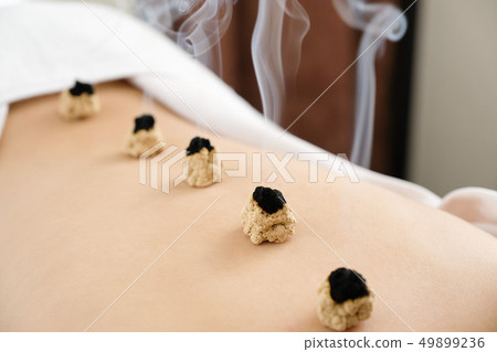 在一個明亮的針灸師的煙霧中放置煙霧 在一個明亮的針灸師的煙霧中放置煙霧 49899236