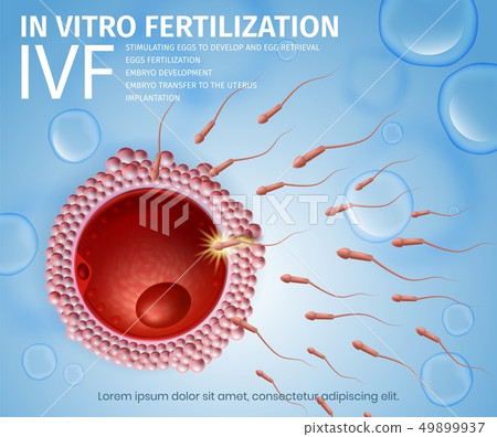 Spermatozoons Cells Flowing Toward Female Egg. 49899937