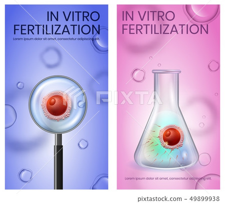 Female Egg Fecundation inside of Test Tube. IVF 49899938