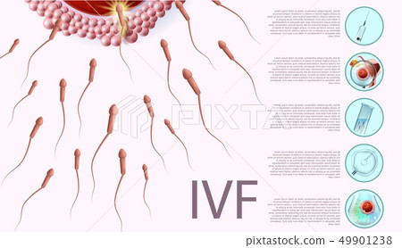 In Vitro Fertilization Informational List, Banner 49901238