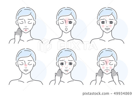 man with acne on face 49934869