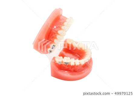 Orthodontic model and dentist tool - demonstration teeth model with ceramic braces on teeth on an 49970125