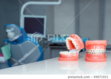 Orthodontic model and dentist tool - demonstration teeth model of varities of orthodontic bracket or Orthodontic model and dentist tool - demonstration teeth model of varities of orthodontic bracket or 49971931