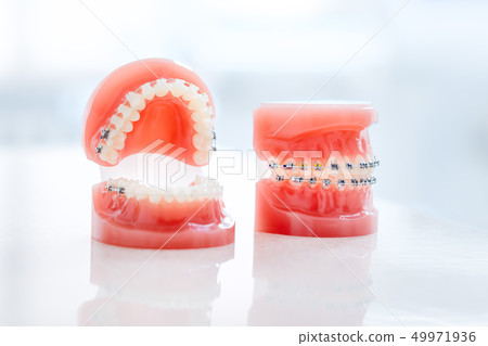 Orthodontic model and dentist tool - demonstration teeth model of varities of orthodontic bracket or 49971936