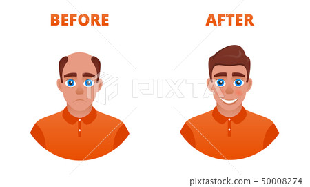 Hair growth concept 50008274