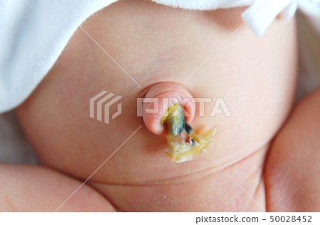 新生兒 新生兒 50028452