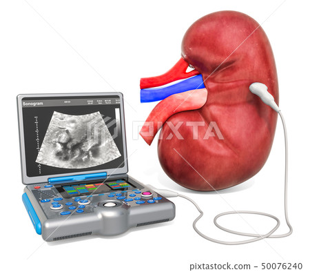 Kidney Ultrasound concept Kidney Ultrasound concept 50076240
