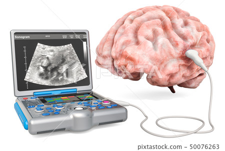 Brain Ultrasound concept 50076263