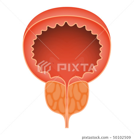 Acute prostatitis on white background. Men s reproductive system disease. Medical vector 50102509