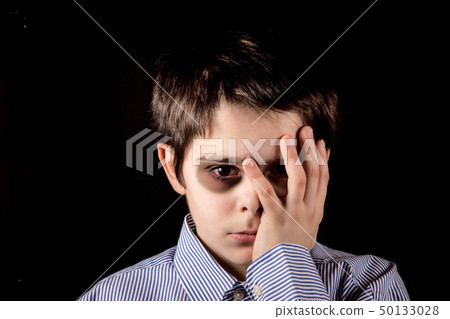 boy with black eye 50133028
