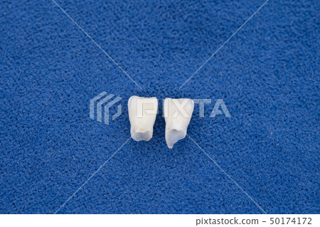 孩子缺牙2下前牙 50174172