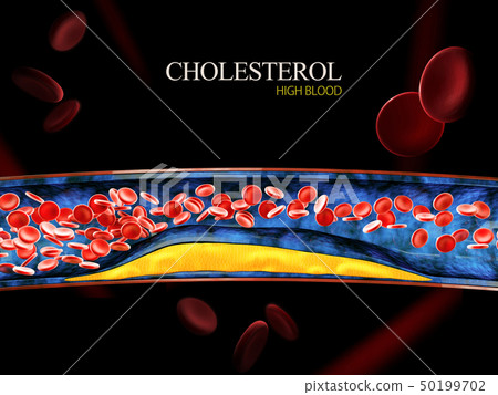 3d Illustration of blood cells with plaque buildup of cholesterol 50199702