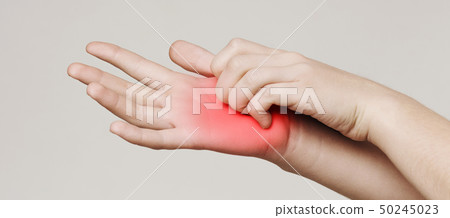 Woman scratching her itchy palm with rash 50245023