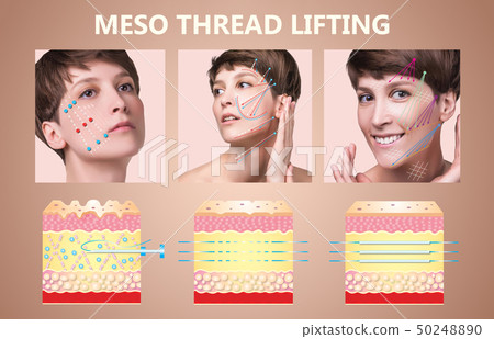 Meso thread Lift. Young female with clean fresh Meso thread Lift. Young female with clean fresh 50248890