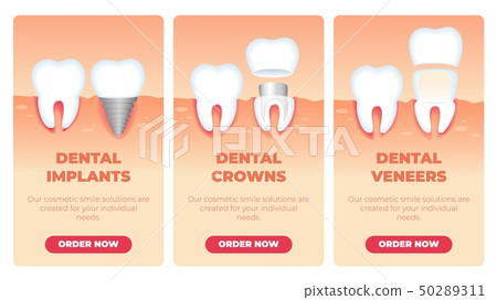 Set Inscription Dental Implants Crowns Veneers. 50289311