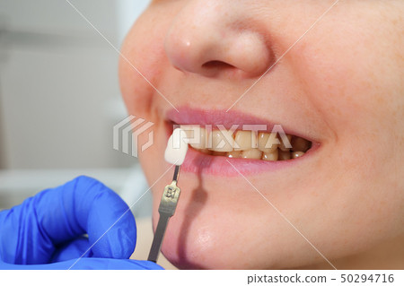 Dentist with tooth color samples is choosing shade for women patient teeth at dental clinic. 50294716