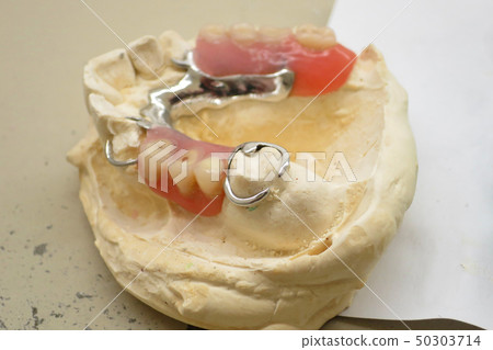 dental laboratory denture dental impressions 50303714