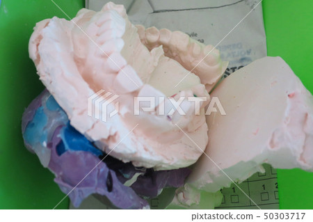 dental laboratory denture dental impressions 50303717