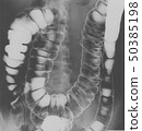 Colon X-ray picture 15 50385198