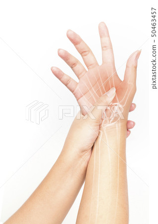 hand bones injury white background hand pain 50463457
