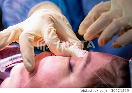 Surgeon and his assistant performing cosmetic surgery on nose in hospital operating room. Nose Surgeon and his assistant performing cosmetic surgery on nose in hospital operating room. Nose 50521259