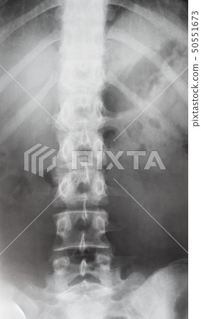 view of human spine in torso on X-ray image 50551673